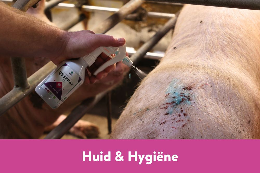 Huid & Hygiëne